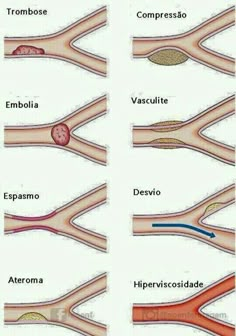 the different types of blood vessels