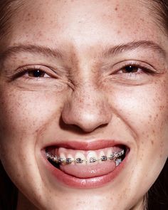 Teeth Photo, Chara Design, Sfx Makeup, Dental Office, Coffee Recipes, Nose Ring