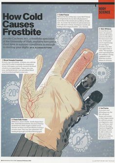 How cold causes frostbite in @menshealthmag Ice Burn On Skin, Frostbite Aesthetic, Cold Weather Running, Running In Cold Weather, Medical Anatomy, Writing Inspiration Prompts, Book Writing Tips, Forensic, Running Tips