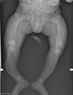 an x - ray image of a man's lower body