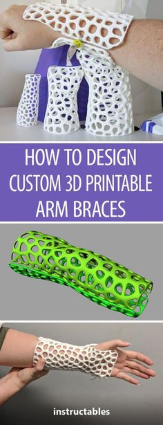 how to design custom 3d printable arm braces