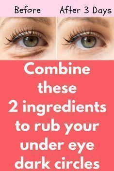 Combine these 2 ingredients to rub your under eye dark circles Today I will share an excellent remedy on how to remove dark circles naturallyThis remedy will also get rid of puffy eyeseyelashesand eye bagsYou must repeat this procedure 3 times in week to get the desired resultsIngredients you will needcucumberpotato MethodFirstlytakecucumberBagsUnderEyes Get Rid Of Eye Bags, Rid Of Eye Bags, Under Eye Dark Circles, Eye Dark Circles, Dark Eye Circles, Christina Grimmie, Natural Healing Remedies, Remove Dark Circles, Smink Inspiration