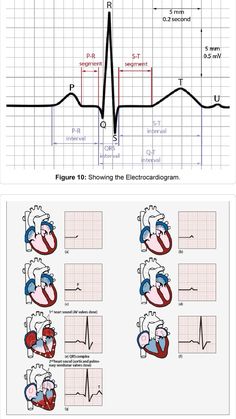 Ekg Technician Aesthetic, Cardiac Technician, Stemi Ekg, 12 Lead Ekg Placement, Ekg Interpretation Made Easy, Ekg Rhythms, Cardiac Sonography, Medical Terminology Study, Cardiology Nursing