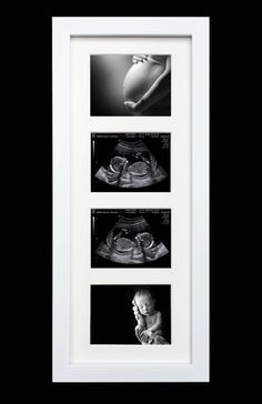 three black and white photographs of baby's feet with their hands in the air