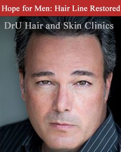 https://www.dru.com/new-body-hair-transplant-study/ Hairline Transplant, Hair Transplant Ads, Hair Transplant Before And After Men, Fue Hair Transplant, Best Hair Transplant, Skin Clinic, Hair Transplant, Body Hair