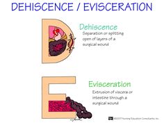 the letter e with different types of words