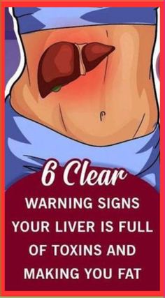 10 Warning Signs of Liver Damage You Shouldnâ€™t Ignore #LiverHealthMatters #HealthyLiverH Liver Damage, What Is Health, Healthy Living Motivation, Health Signs, Women Health Care, Health Tips For Women, Natural Therapy, Liver Health, Health Check