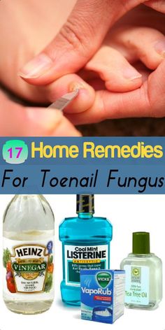 Natural Home Remedies, Health And Beauty Tips, Natural Medicine, Tea Tree Oil