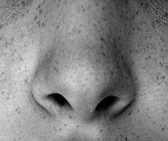 a black and white photo of a woman's face with freckled skin