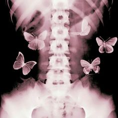 an x - ray shows butterflies flying over the back of a skeleton