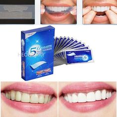 White Strips Teeth, Target Teeth Whitening, Target Teeth Whitening Strips, Dental Bleaching, 5d Gel Teeth Whitening Strips, Discolored Teeth, Teeth Bleaching, Loose Tooth, Teeth Whitening Strips