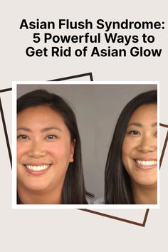 Asian Flush Syndrome: 5 Powerful Ways to Get Rid of Asian Glow Fast Heart Rate, One Glass Of Wine, Virtual Families, Home Remedies For Pimples, Rid Of Ants, Get Rid Of Ants, Armpit Fat, Itching Skin, Worry Dolls