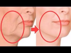 Anti-Aging Face Lifting Massage For Sagging Jowls, Cheeks! Look 20 Years Younger, Tighten The Skin - YouTube Face Lifting Massage, Wrinkles Remedies Face, Face Massage Anti Aging