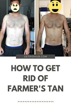 Discover effective methods to fade and prevent farmer's tan lines. Learn practical tips for achieving an even skin tone and enjoying the sun safely. How To Help Sunburn, Farmers Tan, Turmeric Paste, Gap Teeth, Tanning Bed, Bitter Orange, Self Tanner, Spray Tanning, Enjoying The Sun