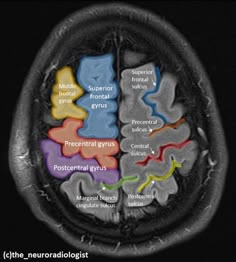 the frontal view of the human brain shows different areas of the cerebratory system