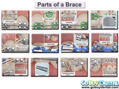 Orthodontic Assistant Tips, Dental Assistant Study, Braces Tips, Brace Face, Dental Life, Dental Facts, Braces Colors, Perfect Teeth, Dental Hygiene