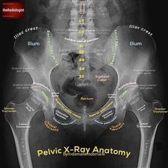 the pelvic x - ray anatomy is shown in black and white, with yellow lettering