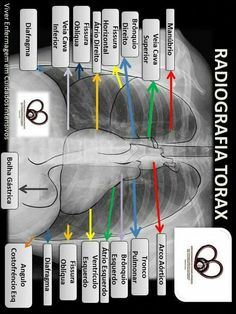 an x - ray shows the location of different areas in the human body and how they are connected to each other