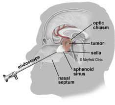 an image of the inside of a human head with parts labeled in english and spanish