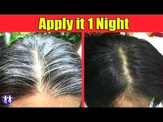 Remedy For White Hair, Prevent Grey Hair, Black And Grey Hair, Black Hair Growth, Grey White Hair, Change Hair, Grow Hair Faster, Grey Hair, Free Hair