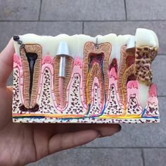 Dental Bridge Cost, Teeth Model, Dental Hygiene Student, Dental Videos, Dentistry Student, Dental Anatomy, Dental Fun