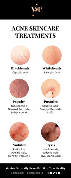 Healthy Skin Care Acne, Facial Exfoliant, Haut Routine, Skin Facts, Skin Advice, Skin Care Routine Order, Skin Care Guide, Clear Healthy Skin