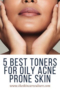 Skin Esthetician, Oily Acne Prone Skin, Acne Toner, Skincare Regimen, Hormonal Acne, Skincare Product, Astringent