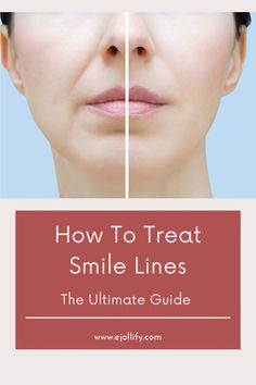 Best Products For Smile Lines, Facial Lines Around Mouth, Lines Around Mouth How To Get Rid, Fine Lines Around Mouth, Getting Rid Of Frown Lines, Filler Around Mouth, Reduce Laugh Lines, Filler Nasolabial Folds, How To Get Rid Of Smile Lines Mouths