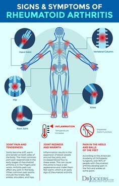 Rheumatoid Arthritis: Symptoms, Causes and Natural Support Strategies Chronic Inflammation, Knee Pain, Health Quotes, Signs, Quotes