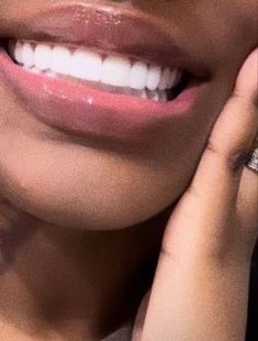 Teeth Aesthetic, Pretty Teeth, Straight Teeth, Perfect Teeth, Yellow Teeth, Smile Teeth, Perfect Smile, Teeth Whitening Kit, Pretty Smile