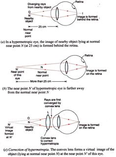 three diagrams showing the different types of lenses