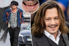 Os dentes de Johnny Depp 'apodrecem' na verdade são desgastes 'agressivos': dentista de celebridades Johnny Depp, Kendall Jenner, Cannes, Hollywood