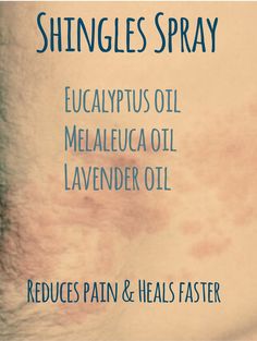 Essential Oils For Shingles, Essential Oils For Pain, Oil Remedies