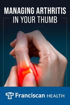 Thumb Pain Relief, Joints Pain Remedy, Arthritic Pain, Pain Relief Remedies, Therapy Exercises, Trigger Finger, Hand Exercises, Wrist Pain, Hand Pain