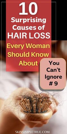 Hair Lossing, Hair Care Tips For Growth, Hair Fall Control Tips, Telogen Effluvium, Hair Wont Grow, Thyroid Hair, Postpartum Hair, Female Pattern Baldness, Tips Hair