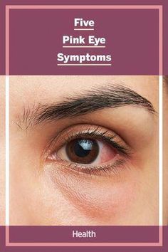 Pink Eye Symptoms Signs, Pink Eye Remedy How To Get Rid Of, How To Get Rid Of Pink Eye Fast, Pink Eye Remedy, Eye Infections