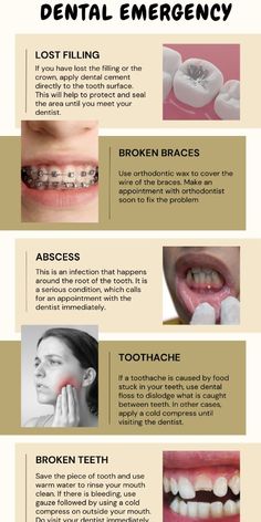 Dental Advertising Ideas Social Media, Dental Abbreviations, Dental Poster, Teeth Tips, Smile Book, Dental Cement, Dental Quotes