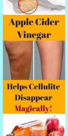 Exercise Weights, Herbal Remedies Recipes, Diy Herbal Remedies, Natural Antibiotics, Diet Exercise, Healthy Lifestyle Tips, Natural Medicine, Natural Living, Cider Vinegar