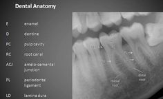 Dentistry Notes, Dental Radiography, Dental Assistant Study Guide, Anatomy Dental, Teeth Whitening Mouthwash