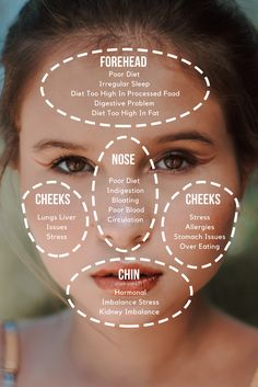 Chinese Facial Mapping, Chinese Medicine Face Map, Chinese Medicine Doctor, Face Mapping Health, Chinese Face Map, Chinese Face Reading, Face Map, Internal Health, Tcm Traditional Chinese Medicine