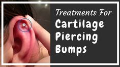 an ear is shown with the words treatments for cartilage piercing bumps on it