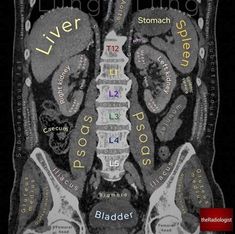 an x - ray shows the location of the liver