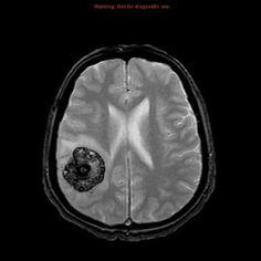 an mri scan shows the area where it is located and what appears to be in the middle