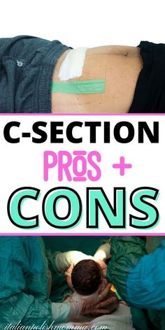 A c-section delivery and a mom's stomach after a c-section showing her c-section scar. Pregnancy Planning Resources, Scheduled C Section, C Section Workout, Cesarean Delivery, Third Trimester Pregnancy, Natural Childbirth, Emergency C Section