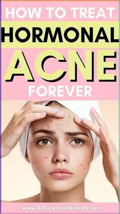 Read on for adult acne treatment and adult acne causes   how to get rid of adult acne. We give you an adult acne skin care routine with adult acne remedies and an adult acne-safe diet. Acne Skin Care Routine, Hormonal Acne Remedies, Teenage Acne, Acne Tips, Acne Prone Skin Care, Teen Skincare, Acne Skincare Routine, Acne Causes, Clear Skin Tips