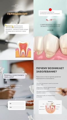 Instagram Ads Design, Dental Emergency, Board Game Design, Instagram Ads, Dental Clinic, Instagram Feed, Social Media Marketing