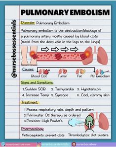 the diagram shows how to use an embolism