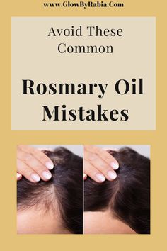 Is rosemary oil worth the hype? Hair loss and hair thinning can be very upsetting and can take a toll on our self-confidence. Check out this pharmacist guide to what you can do today to stop hair from thinning and how to boost hair growth from home. thinning hair| hair thinning women| thinning hair remedies| how to stop hair from falling out| how to stop hair thinning| hair growth| hair growth tips| hair growth faster| rosemary for hair loss Rosemary For Hair, Regrow Hair Naturally, Thinning Hair Remedies, Hype Hair, Healthy Natural Hair Growth, Rosemary Oil For Hair, Tips Hair, Growth Hair, Castor Oil For Hair