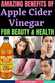 APPLE CIDER How To Use Apple Cider Vinegar For Hair, Apple Cider Vinegar Benefits For Skin, Braggs Apple Cider Vinegar Benefits, Apple Cider Viniger, Acv Uses, Muscle Gain Diet