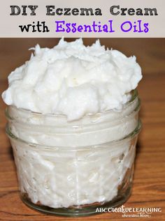 Eczema Cream with Essential Oils - simplytodaylife.com Diy Essential Oil Recipes, Anti Itch Cream, Homemade Lotion, Homemade Diy, Young Living Oils, Doterra Essential Oils, Essential Oil Recipes, Diy Homemade